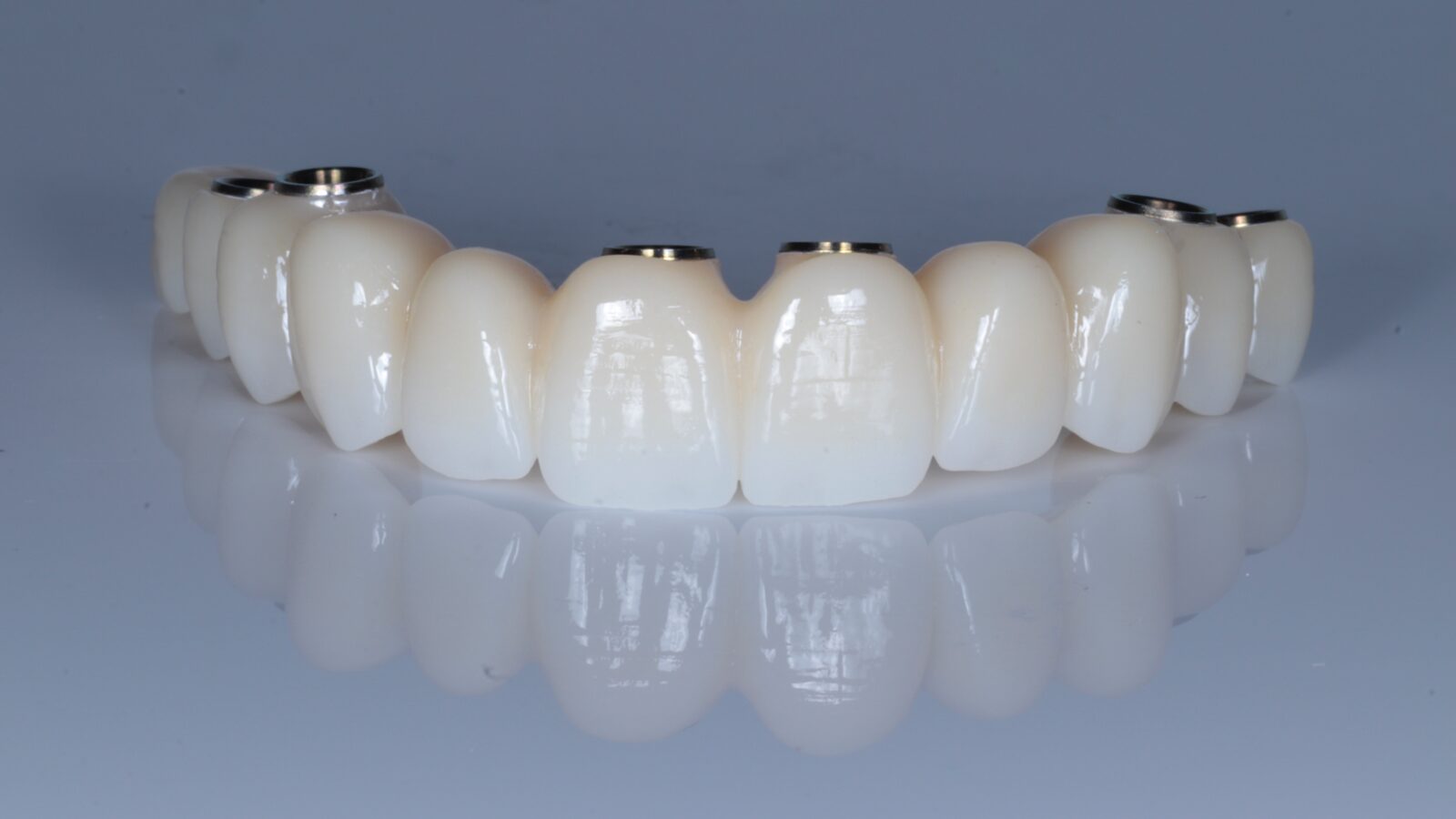 FP1 full-arch fixed prosthesis, replacing teeth only, without a pink gingival component